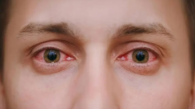 طبيبة: 3 فيتامينات يجب تناولها لصحة العيون